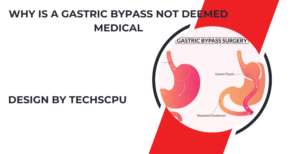 why is a gastric bypass not deemed medical