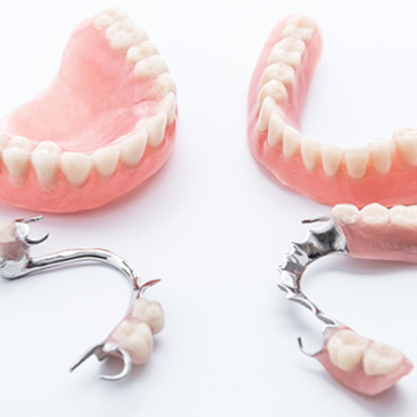 Combining Partial Dentures With Other Dental Treatments