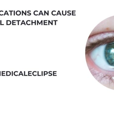 What Medications Can Cause Retinal Detachment