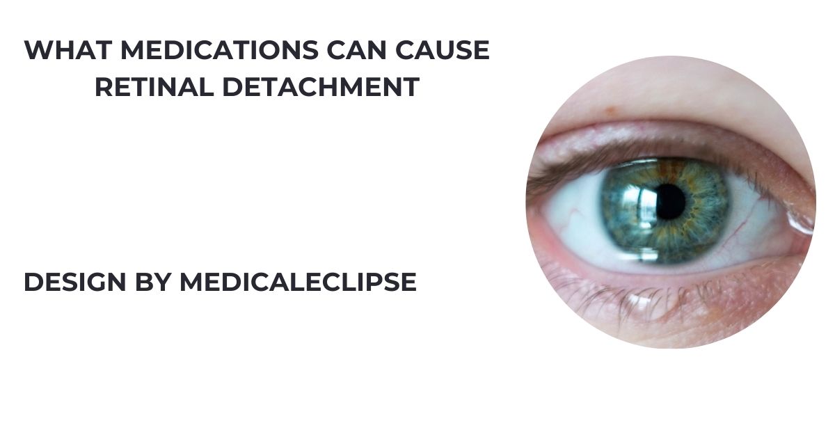 What Medications Can Cause Retinal Detachment