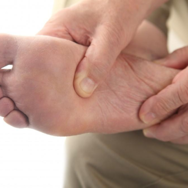 How Flat Feet Affect Your Daily Life and Health