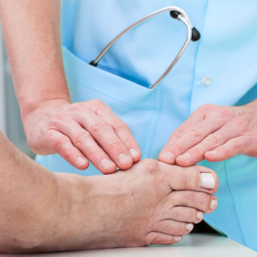 Early Signs of a Bunion and How to Manage Them