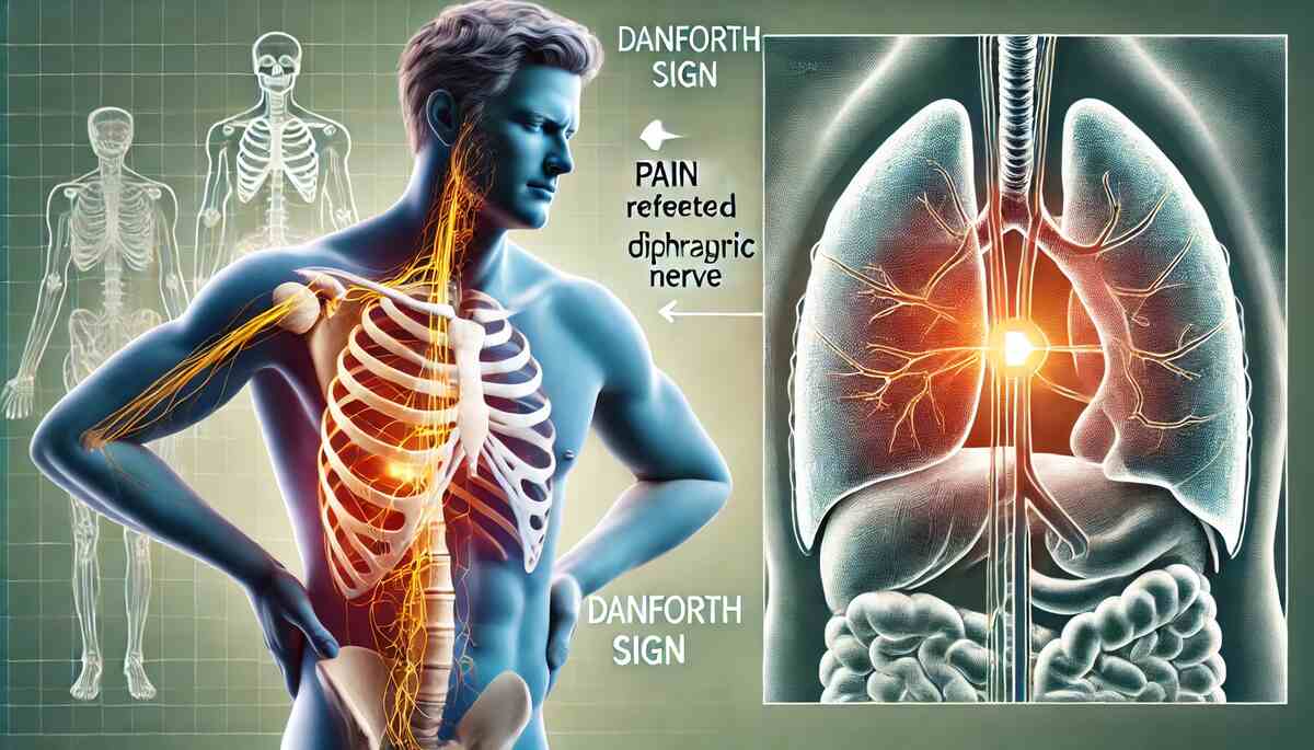 What Causes Danforth Sign Medical