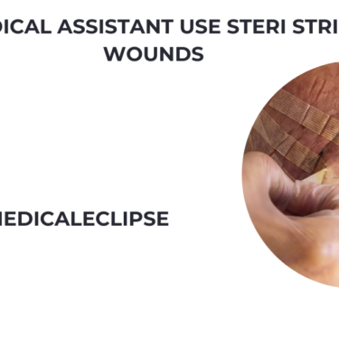 can medical assistant use steri strips on wounds