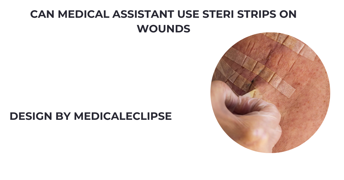 can medical assistant use steri strips on wounds